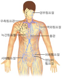 림프부종3.png