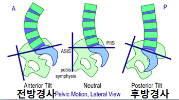 골반02.png